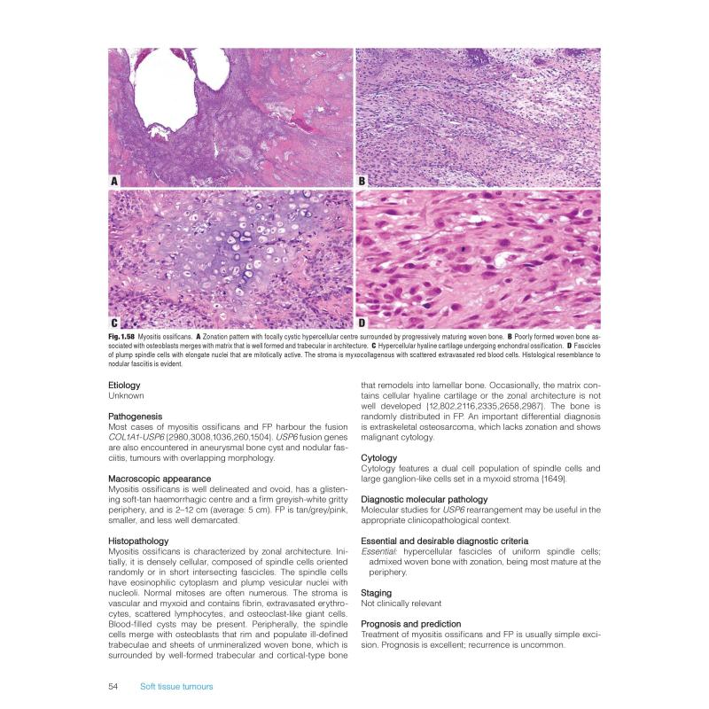 Soft Tissue and Bone Tumours: WHO Classification of Tumours, 5th ...